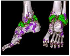 Alternativa 3-1