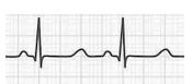Alternativa 1-1