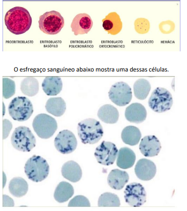 Enunciado 4672240-1